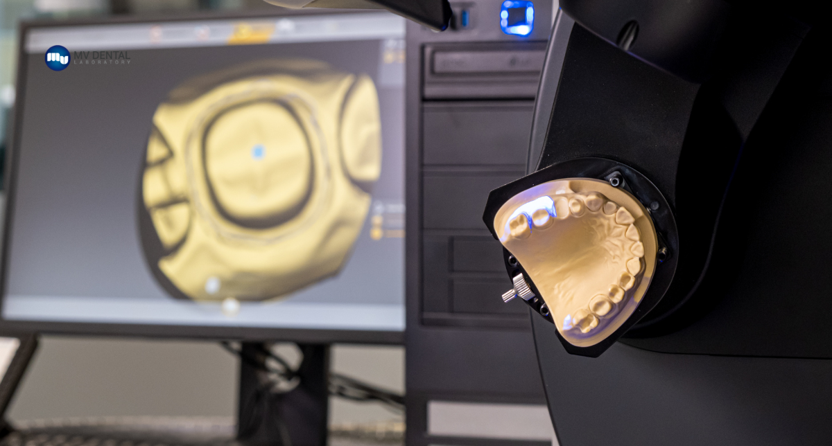 Level Up Your Dental Lab with AI