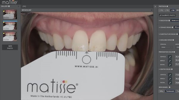 Teeth with card 