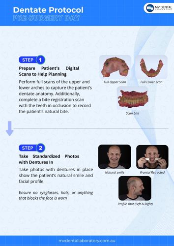 Dentate Protocol Pre-surgery image